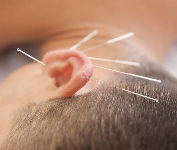 Ohrakupunktur als Folgebehandlung bei Stress, Schmerzen, Allergien oder zur Unterstützung bei Schlaf und Entwöhnung.